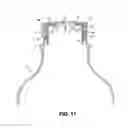 Fig. 07 - Flow restrictor