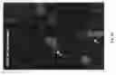 Fig. 05 - Non-Invasive Imaging Methods for Patient Selection for Treatment with Nanoparticulate Therapeutic Agents