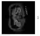 Fig. 16 - Non-Invasive Imaging Methods for Patient Selection for Treatment with Nanoparticulate Therapeutic Agents