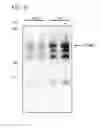 Fig. 06 - Polymeric IgA-type recombinant antibody and use thereof
