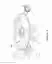 Fig. 09 - METHOD AND APPARATUS FOR FACILITATING DELIVERY OF ANAESTHETIC