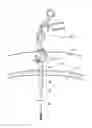 Fig. 01 - Access sealing apparatus and method