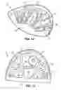 Fig. 09 - Mixed material golf club head