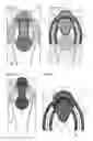 Fig. 04 - Package material and package container formed with said material