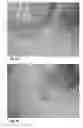 Fig. 12 - Tray-shaped article having smooth edges and amenable to multiple film sealing methods