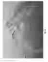 Fig. 15 - Tray-shaped article having smooth edges and amenable to multiple film sealing methods