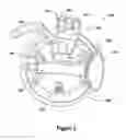 Fig. 03 - Rope dispensing device