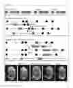 Fig. 02 - Protein Comprising a Collagen Domain of CCBE1 and Uses Thereof