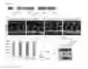 Fig. 07 - Protein Comprising a Collagen Domain of CCBE1 and Uses Thereof