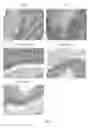 Fig. 08 - Method for and use of blocking immunosuppressive functions of pathogens