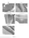 Fig. 09 - Method for and use of blocking immunosuppressive functions of pathogens