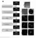 Fig. 01 - Oligodendroglial cell culturing methods and in methods for treating neurodegenerative disorders by using thyroid hormones or analogues