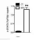 Fig. 02 - Methods for the prevention and the treatment of extracapillary glomerulonephritis
