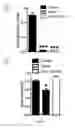 Fig. 07 - Methods for the prevention and the treatment of extracapillary glomerulonephritis