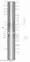 Fig. 01 - Downhole tubular expansion tool and method for installing a tandem clad liner