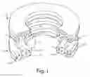Fig. 02 - Radial-loading Magnetic Reluctance Device