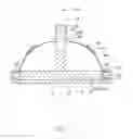 Fig. 02 - STRESS SENSING DEVICE