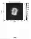 Fig. 09 - Particle emission tomography