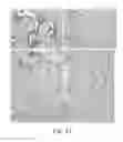 Fig. 35 - Histochemical assay for evaluating expression of programmed death ligand 1 (PD-L1)