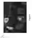 Fig. 09 - Hierarchical context-aware extremity detection