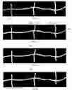 Fig. 07 - Robust method for tracing lines of table