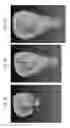 Fig. 02 - Tooth axis estimation program, tooth axis estimation device and method of the same, tooth profile data creation program, tooth profile data creation device and method of the same