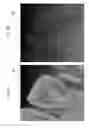 Fig. 06 - Tooth axis estimation program, tooth axis estimation device and method of the same, tooth profile data creation program, tooth profile data creation device and method of the same