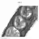 Fig. 09 - Tooth axis estimation program, tooth axis estimation device and method of the same, tooth profile data creation program, tooth profile data creation device and method of the same