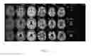 Fig. 07 - Method, device and non-transitory digital storage medium for non-aqueous tissue volume estimation