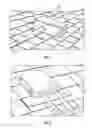 Fig. 02 - Bracket mounting assembly for securing junction boxes to solar panel arrays
