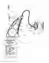 Fig. 01 - Hearing aid comprising a beam former filtering unit comprising a smoothing unit