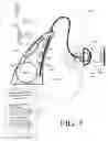 Fig. 09 - Hearing device comprising a filterbank and an onset detector