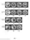 Fig. 09 - QUATERNARY DISINFECTANT COMPOSITION WITH ANIONIC SCALE INHIBITING AGENT
