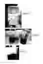 Fig. 02 - Formulations and methods for controlling rootworm larvae
