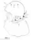 Fig. 02 - Helmet for attenuating impact event