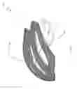 Fig. 02 - Mechanically joined helmet bodies and method for same