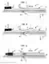 Fig. 04 - Self-righting toothbrush