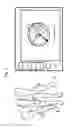 Fig. 09 - Calibration device for inertial sensor based surgical navigation system