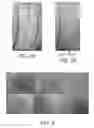 Fig. 02 - METHOD AND APPARATUS FOR USE IN ALLERGY TESTING