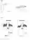 Fig. 07 - Methods and apparatus for the assessment of gingival blood flow