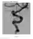 Fig. 02 - VASCULAR TREATMENT EVALUATION SYSTEM, AND METHOD THEREFOR