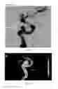 Fig. 09 - VASCULAR TREATMENT EVALUATION SYSTEM, AND METHOD THEREFOR