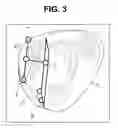 Fig. 04 - Medical apparatus, medical-image generating method, and recording medium on which medical-image generating program is recorded