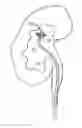 Fig. 01 - METHODS AND SYSTEMS FOR REMOVING TISSUE FROM BODY CAVITIES