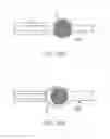 Fig. 09 - METHODS AND SYSTEMS FOR REMOVING TISSUE FROM BODY CAVITIES