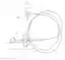 Fig. 01 - OPEN LOOP POLYPECTOMY SYSTEM