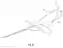 Fig. 09 - OPEN LOOP POLYPECTOMY SYSTEM