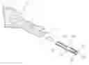 Fig. 01 - Intramedullary implant and method of use