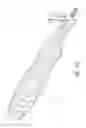 Fig. 09 - Intramedullary implant and method of use