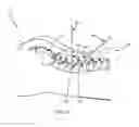 Fig. 09 - Method and apparatus for minimally invasive posterolateral spinal fusion